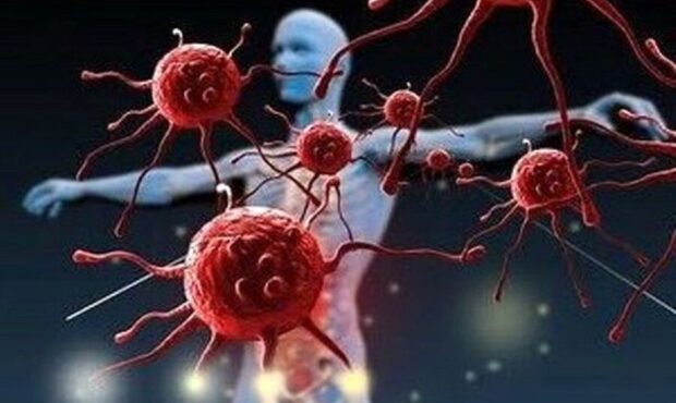 کشف درمان سرطان استخوان تا سرمایهگذاری ۱۱۰۰ میلیارد ریالی در علوم پزشکی سمنان کشف درمان سرطان استخوان تا سرمایهگذاری ۱۱۰۰ میلیارد ریالی در علوم پزشکی سمنان